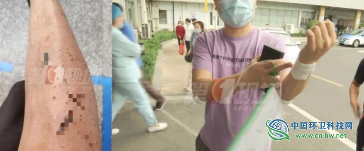 深圳环卫工火碱洗涤路面，市民频频烧伤岂止环卫企业之责